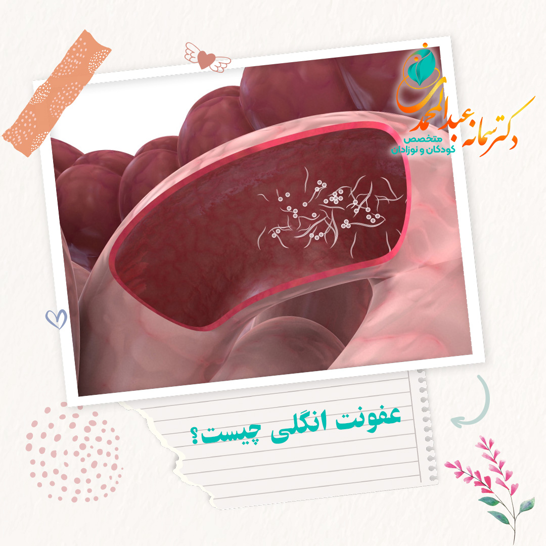 عفونت انگلی چیست؟