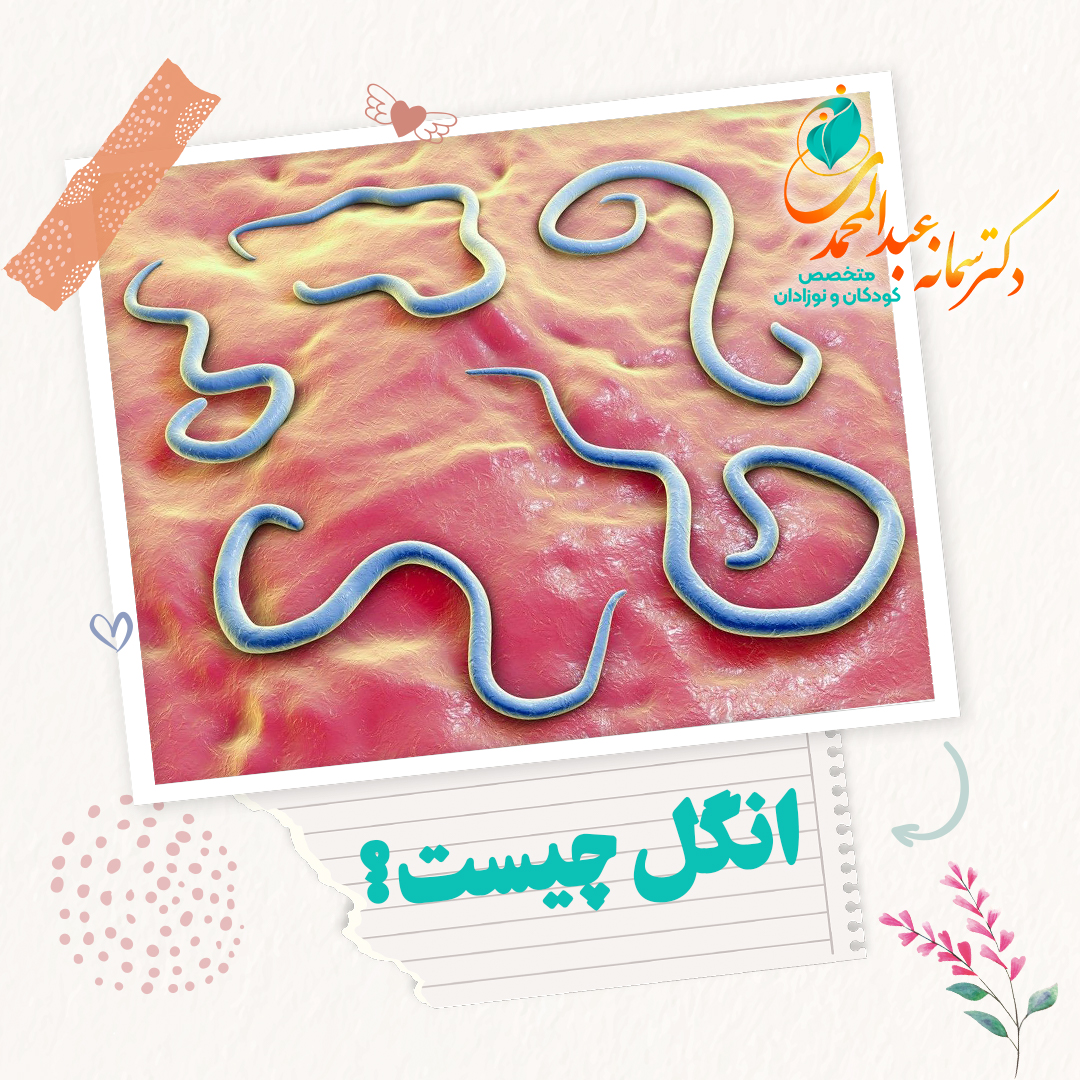 انگل چیست؟