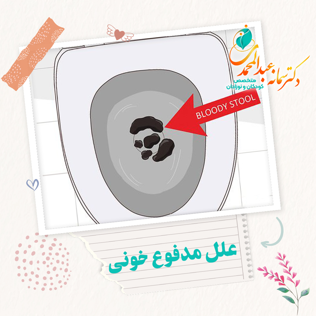 علل مدفوع خونی روشن یا هماتوشزی